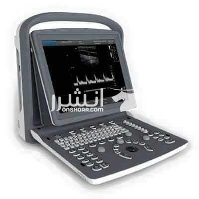 جهاز Chison ECO1    black and white  1 بروب  2سوكت  مخرج شاشه  مخرج فيديوبرنتر  مخرجUSB  الاسعار مفاجاه