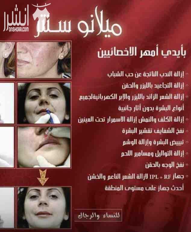 مركز ميلانو   خصم علي جلسات اليزر 30/  عرض علي جلسات الميزو  والبلازما حقن الفلير والبوتكس  احدث جهاز لتكسير الدهون