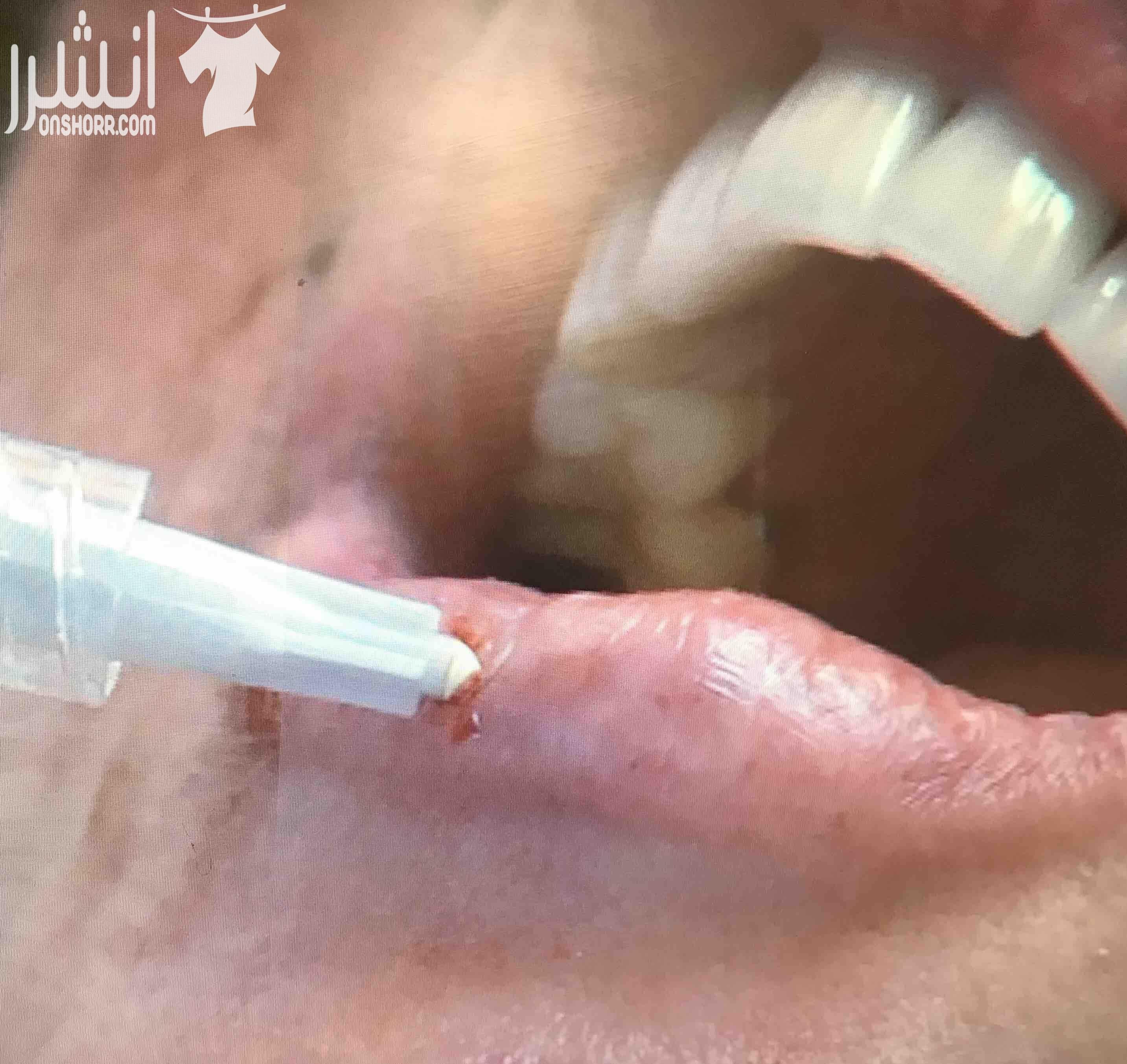 مركز ميلانو