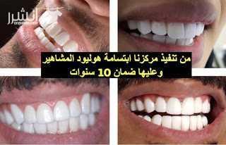 خصم 50% على قسم الاسنان والليزر والبشرة والتجميل 1- ⭐ ليزر كامل الجسم 3جلسات 3جلسات رتوش (شامل الشعر الوبري تشقير الحواجب تنظيف اسنان تركيب الماسه) 1488 ريال 2- ⭐ جلسة تشقير حواجب 88 3- جلسة ت...
