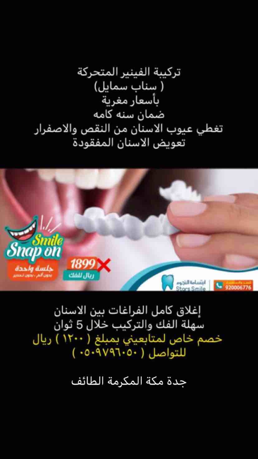 تركيبة الفينير المتحركة :
(سناب سمايل )
بأسعار مغرية .
* سناب سمايل : (سعر 1200ريال  سعودي )
1_بدون تحضير الاسنان .
2-بدون تصغير وبرود الاسنان .
3-تصليح شكل الاسنان الغير منتظمة.
4-إغلاق كامل الفراغات...