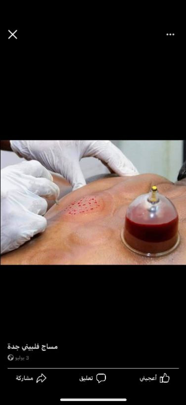 مساچ فلبيني اندونيسي تايلاندي مصري/حجامه اسلاميه/حمام مغربي/ازاله شعر/تجهيز عرسان/رقم الجوال والواتس/0541873871