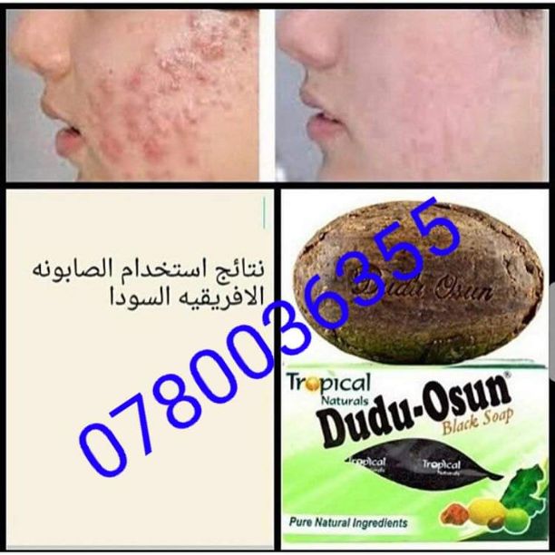صابون دودو الافريقى الاسود الأصلي ? 8 دنانير شامل التوصيل 0780036355 للطلب ابعتي واتساب
♥ ازالة أثار حب الشباب :
حب الشباب ليس سببه التلوث اللذي يأتي من الطبيع’ او الجو ولكن يكون نتيجة...