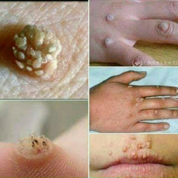 ميلانو سنتر 
عروض خاصه بمناسبه فصل الشتا