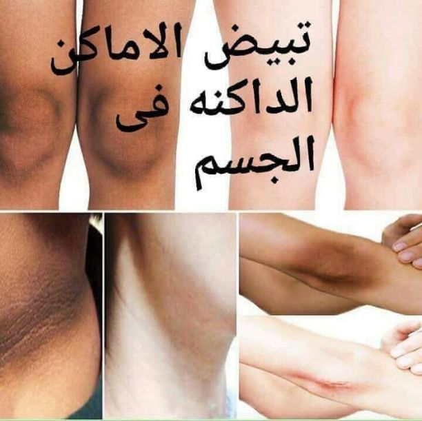 عرررض لفتررره علبتين من 9 دنانير شامل التوصيل ? ?3 علب 12 دينار شامل التوصيل ❤️❤️

كبسولات للتبييض الفوري والدائم ??0780036355

ادخلو الصفحه وشوفو الفيديو ????

كبسولات فيتامين vitamin E للتبييض الأصل...