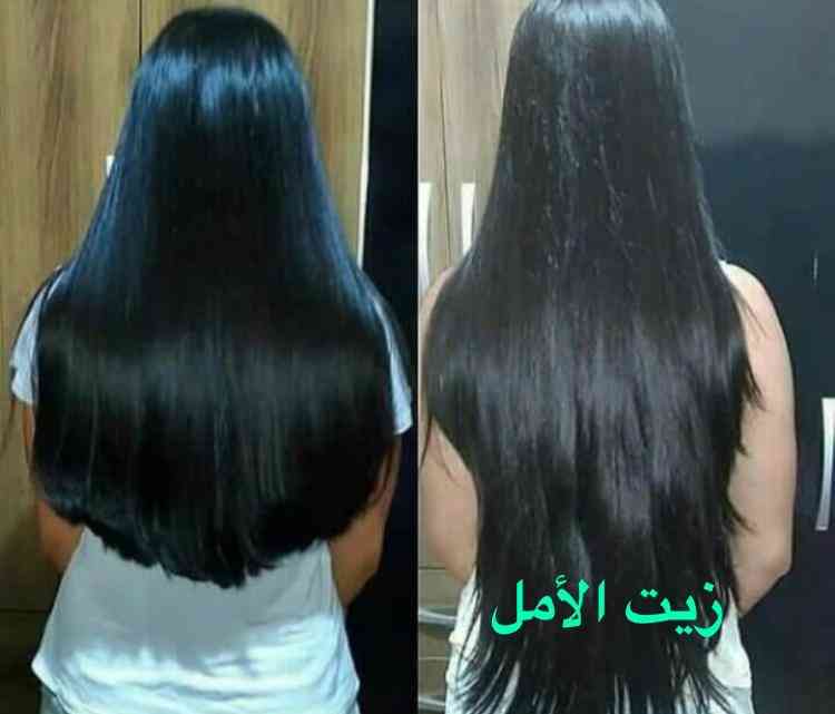 زيت الأمل لتنعيم الشعر وتطويله
لا تنسَ أنك شاهدت هذا الإعلان في عنكبوت
زيت الأمل
يساعد على ت...