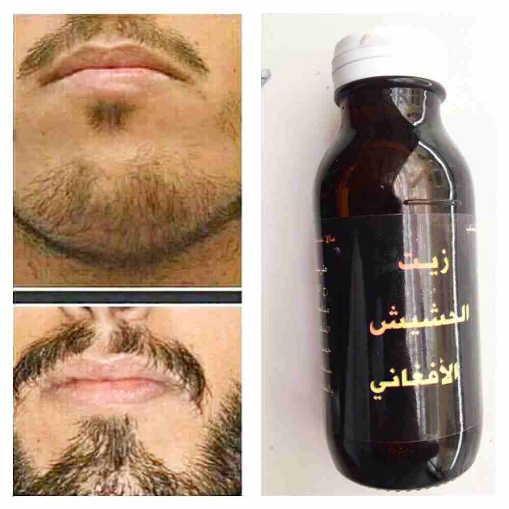 منتج الافغاني لحل مشاكل تساقط الشعر
لا تنسَ أنك شاهدت هذا الإعلان في عنكبوت
السلام عليكم ورحمة ال...