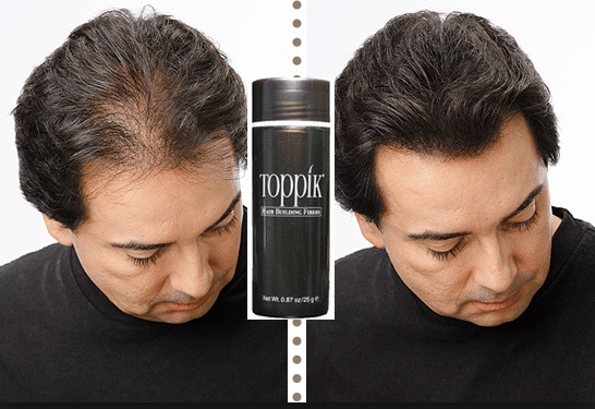 TOPPIK , Hair Building Fibers
لا تنسَ أنك شاهدت هذا الإعلان في عنكبوت
فراغات الشعر !!!
ولا يهمك...