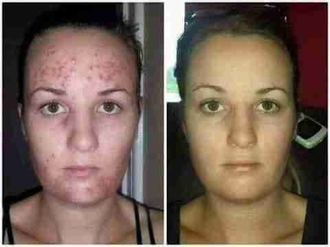 ومينس منظف البشرة لاستعادة شباب LUMINESCE YOUTH RESTORING CLEANSER                                            


	 				لا تنسَ أنك شاهدت هذا الإعلان في عنكبوت...