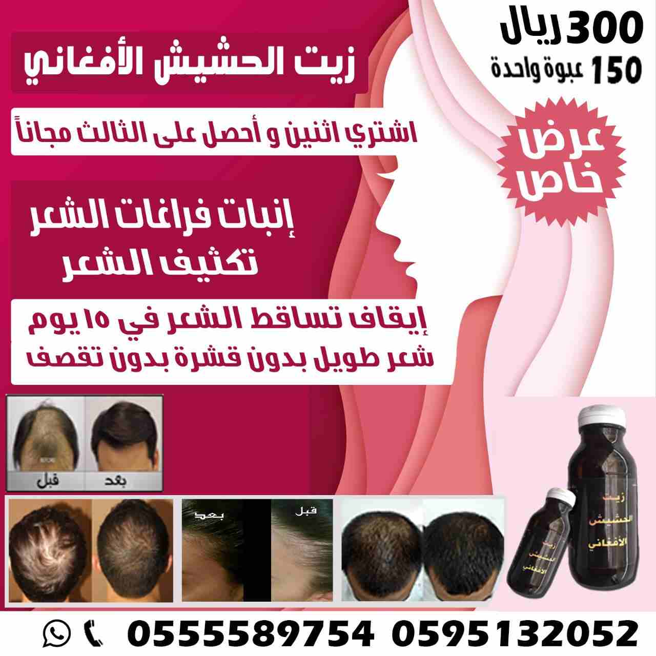 زييت الشعر الافغاني لتساقط الشعر اصلي و مجرب و فعال
لا تنسَ أنك شاهدت هذا الإعلان في عنكبوت
حصريا...