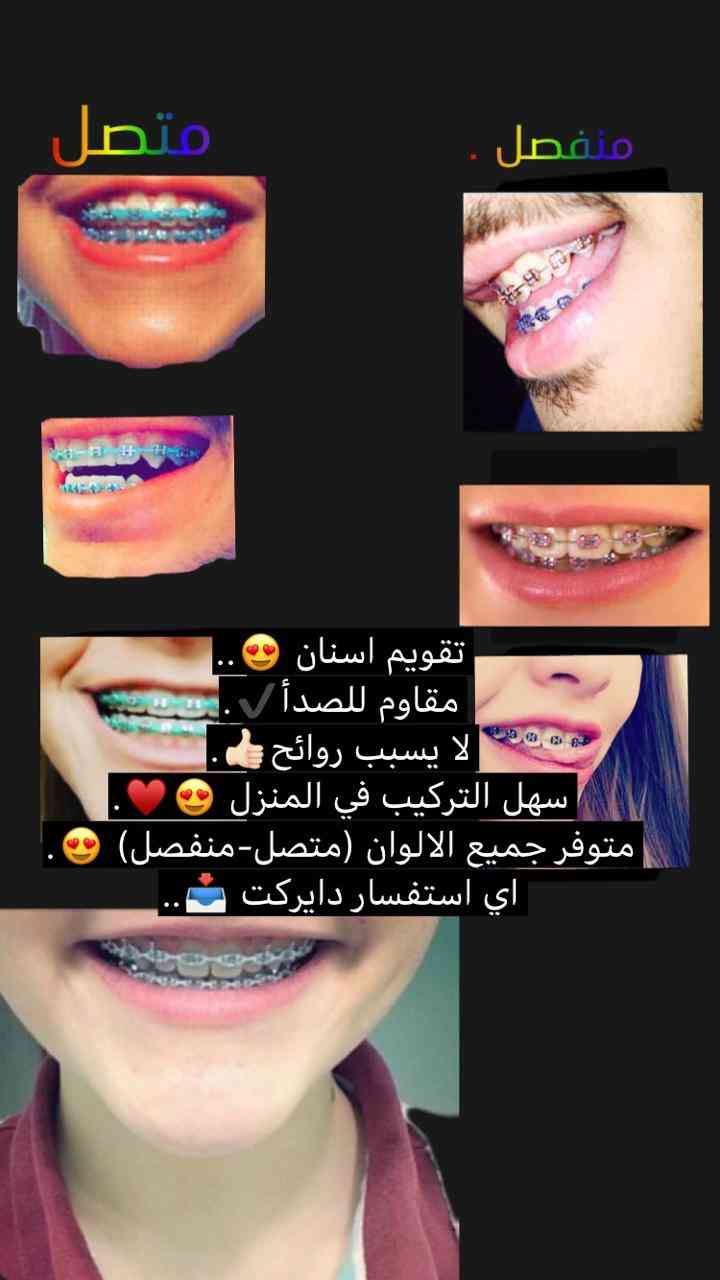 تقويم اسنان زينه                                            


	 				لا تنسَ أنك شاهدت هذا الإعلان في عنكبوت            
	 				
                                تقويم اسنان زينه
متوفر بجميع الالوان...