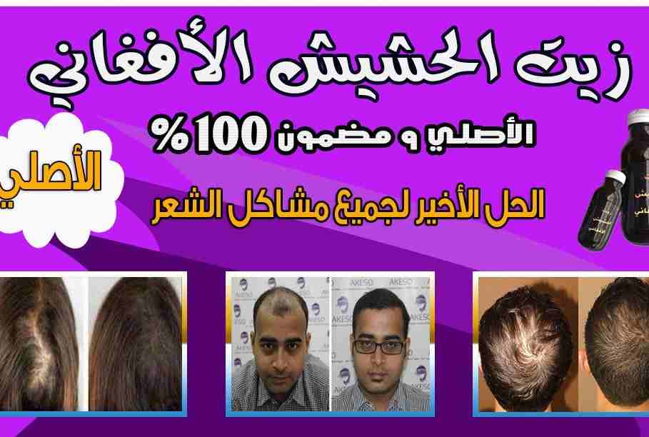 منتج الافغاني لحل مشاكل تساقط الشعر
لا تنسَ أنك شاهدت هذا الإعلان في عنكبوت
السلام عليكم ورحمة ال...