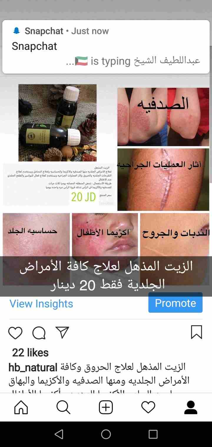 علاج الصدفيه والأكزيما وعلاج تساقط الشعر                                            


	 				لا تنسَ أنك شاهدت هذا الإعلان في عنكبوت            
	 				
                            يوجد لدي منتجات...