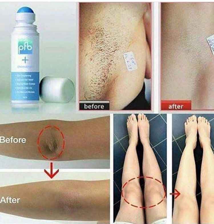 مقشر فانيش مبيض مفتح للبقع                                            


	 				لا تنسَ أنك شاهدت هذا الإعلان في عنكبوت            
	 				
                                واتساب
https://api.whatsap...