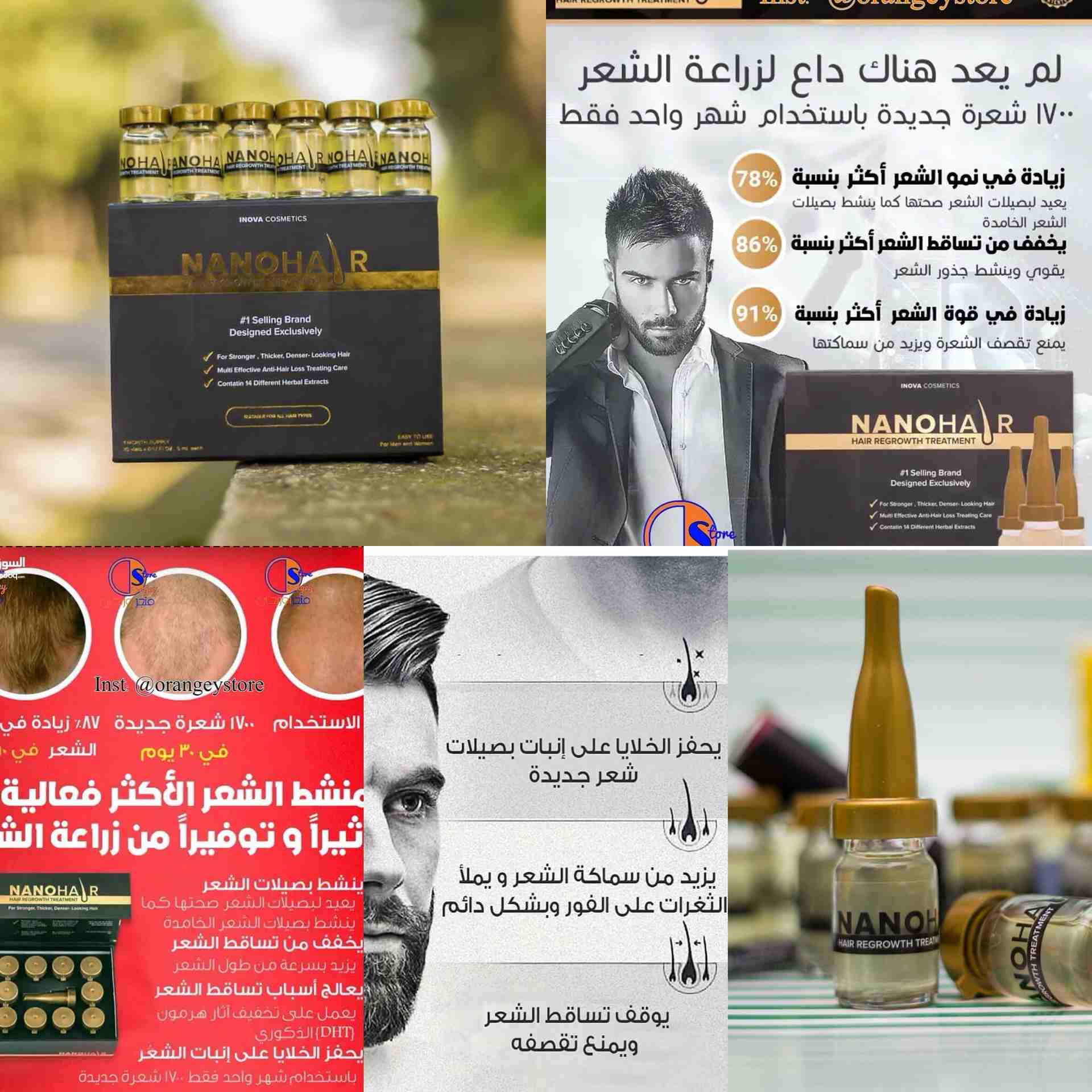 نانو هير التركي لتكثيف و نمو شعر الرأس                                            


	 				لا تنسَ أنك شاهدت هذا الإعلان في عنكبوت            
	 				
                            نانو هير التركي لت...
