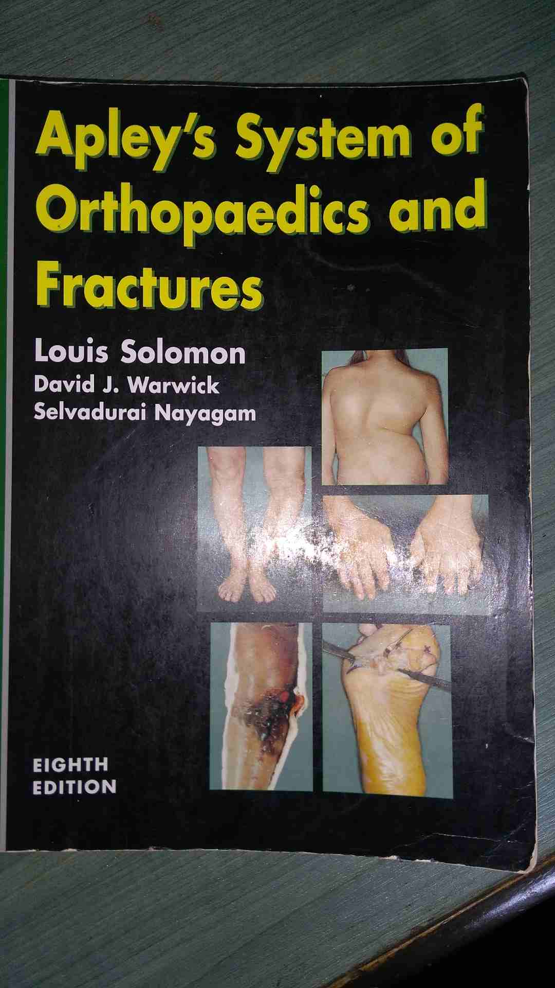 كتب طبية بحاله فوق الممتازه وكأنها جديده
لا تنسَ أنك شاهدت هذا الإعلان في عنكبوت
كتب طبيه وكاله...
