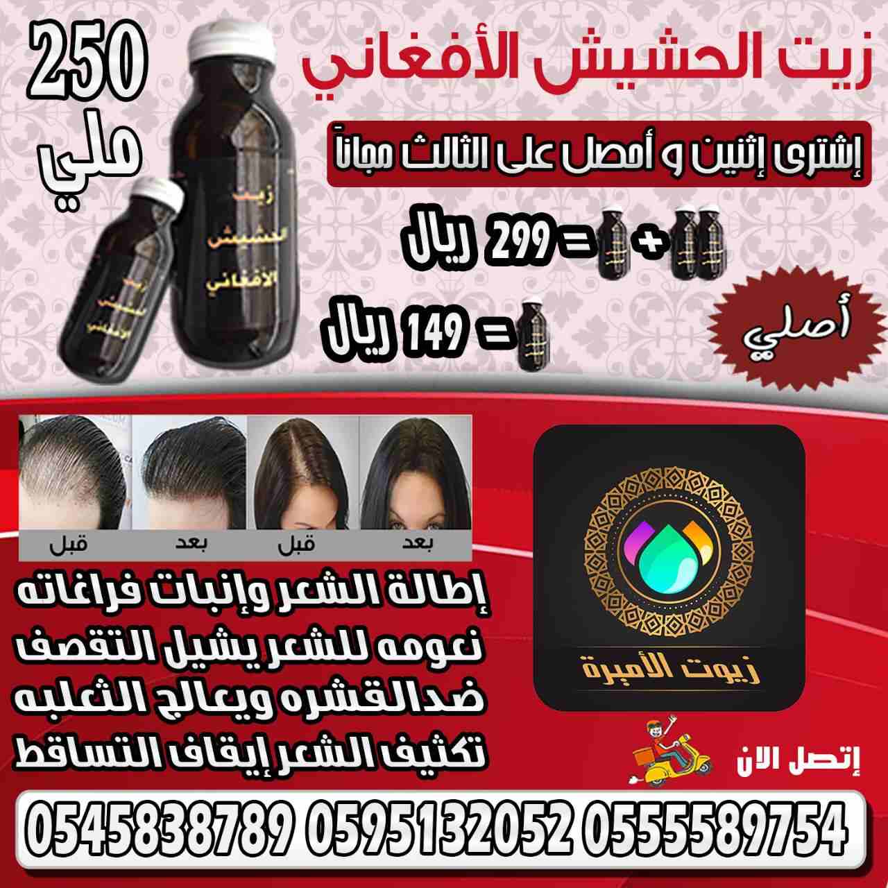 زييت الشعر الافغاني لتساقط الشعر اصلي و مجرب و فعال
لا تنسَ أنك شاهدت هذا الإعلان في عنكبوت
حصريا...
