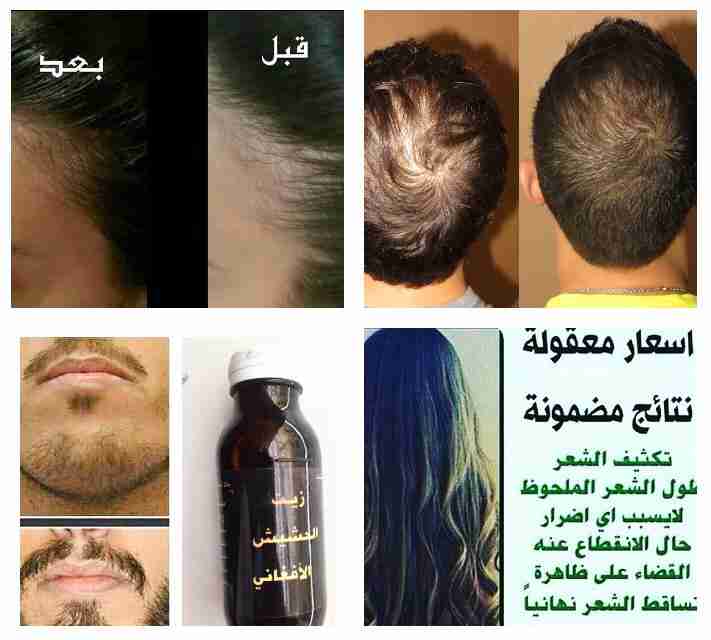 ززييتت الحششييشش الافغاني الاصلي مجرب فعال                                            


	 				لا تنسَ أنك شاهدت هذا الإعلان في عنكبوت            
	 				
                                السلام علي...