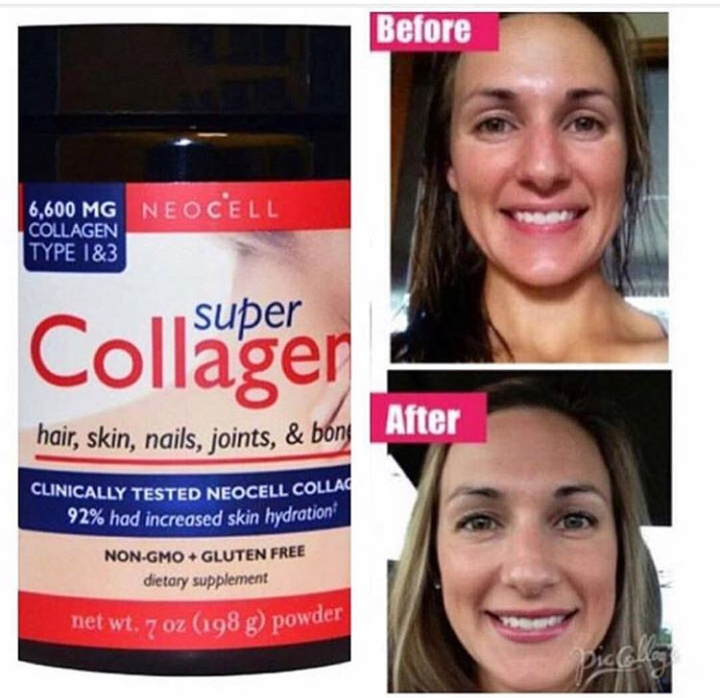 حبوب الكولاجين الأمريكية
لا تنسَ أنك شاهدت هذا الإعلان في عنكبوت
#collagen
حبوب الكولاجين ال...