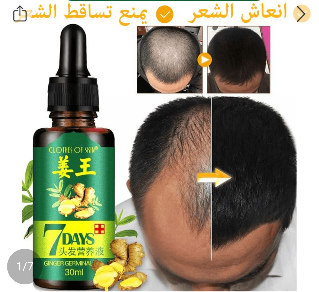 زيت انبات الشعر وحل مشاكل تساقط الشعر
لا تنسَ أنك شاهدت هذا الإعلان في عنكبوت
زيت انبات الشعر وحل...