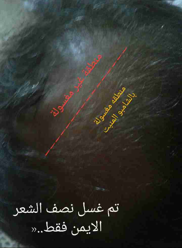 شامبو انبات الشعر القوي Repair,غير مصدق»
لا تنسَ أنك شاهدت هذا الإعلان في عنكبوت
شامبو...