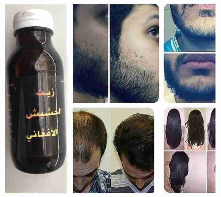 ززييتت الحششييشش الافغاني الاصلي مجرب فعال
لا تنسَ أنك شاهدت هذا الإعلان في عنكبوت
السلام علي...