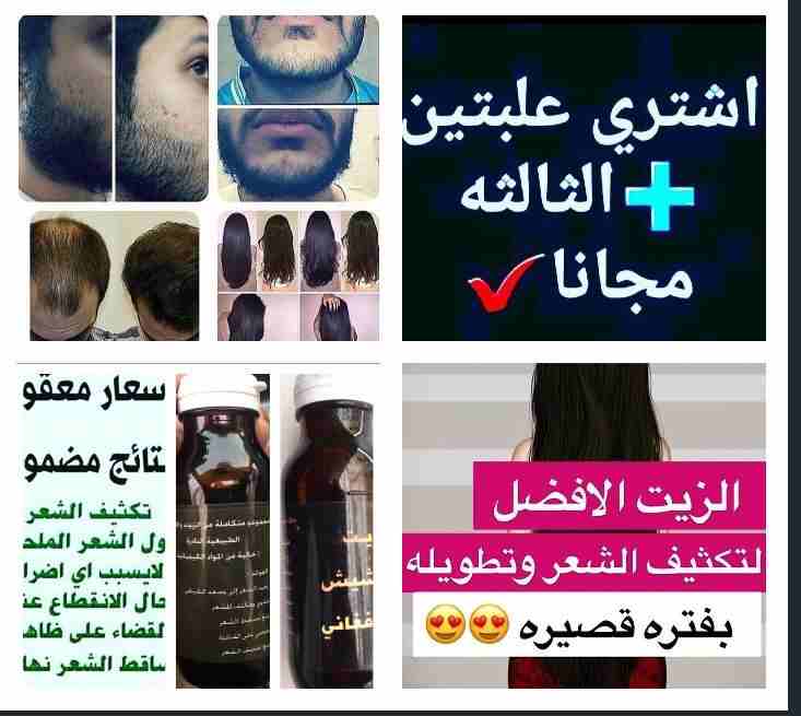 منتج الافغاني لحل مشاكل تساقط الشعر
لا تنسَ أنك شاهدت هذا الإعلان في عنكبوت
السلام عليكم ورحمة ال...