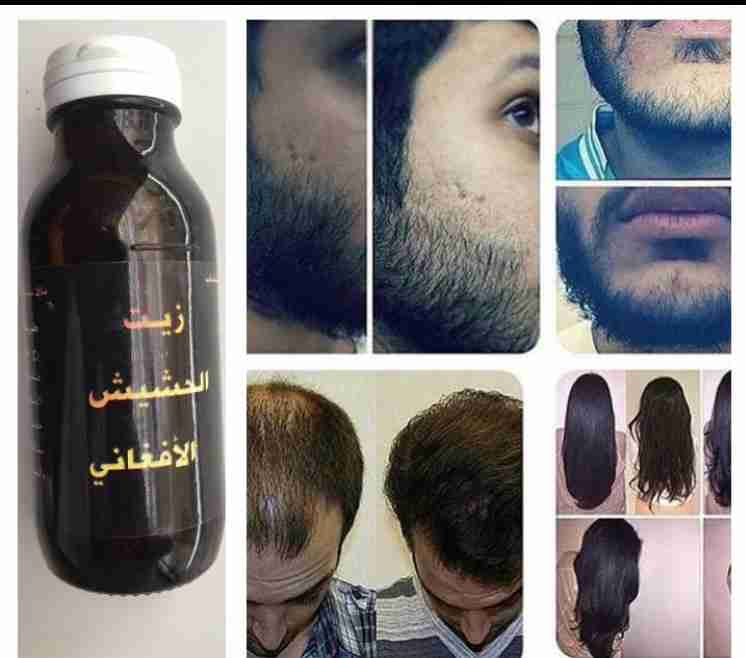 زيت الححششييش الافغاني
لا تنسَ أنك شاهدت هذا الإعلان في عنكبوت
منتج الافغاني مضمون ومجرب وفعا...