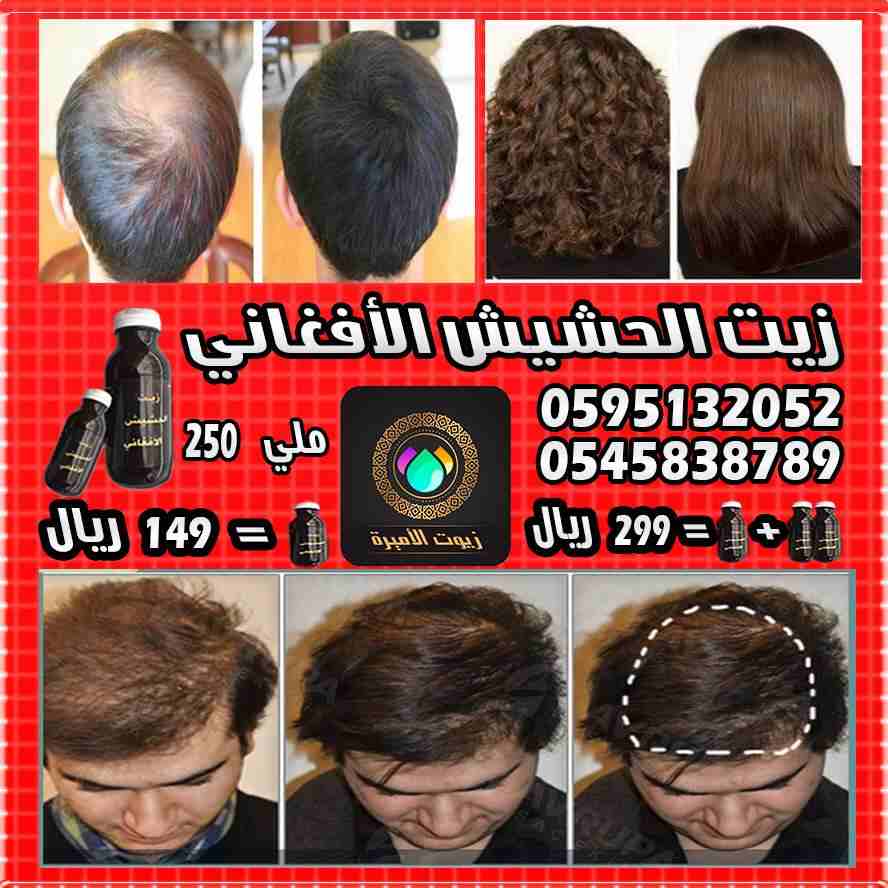 زييت الشعر الافغاني لتساقط الشعر اصلي و مجرب و فعال
لا تنسَ أنك شاهدت هذا الإعلان في عنكبوت
حصريا...