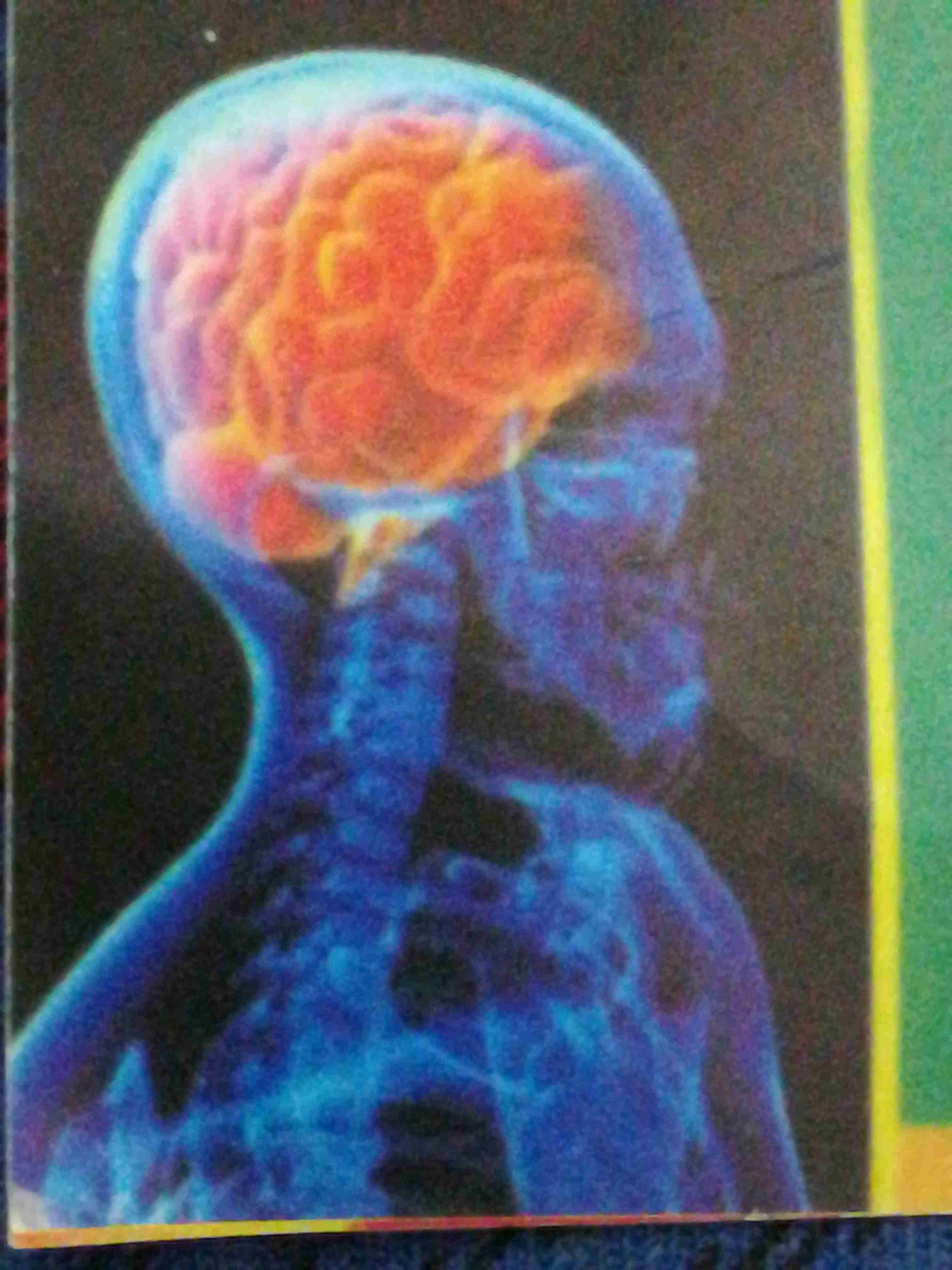 فنية تخطيط دماغ                                            


	 				لا تنسَ أنك شاهدت هذا الإعلان في عنكبوت            
	 				
                                فنية تخطيط دماغ مع جهاز متنقل بخبرة 1...