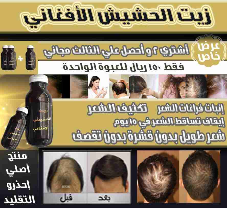 المنتج الاقوى ززييت الحششييشش الافغاني لتكثيف الشعر ومنع التقصف                                            


	 				لا تنسَ أنك شاهدت هذا الإعلان في عنكبوت...