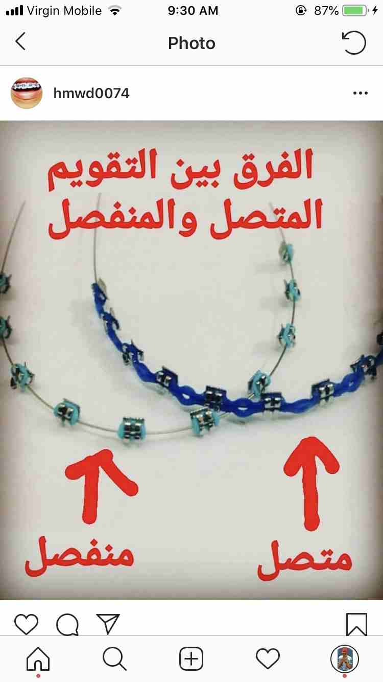 تقويم اسنان زينه فوق وتحت متوفر الوان.
لا تنسَ أنك شاهدت هذا الإعلان في عنكبوت
التقويم يتكون من ف...