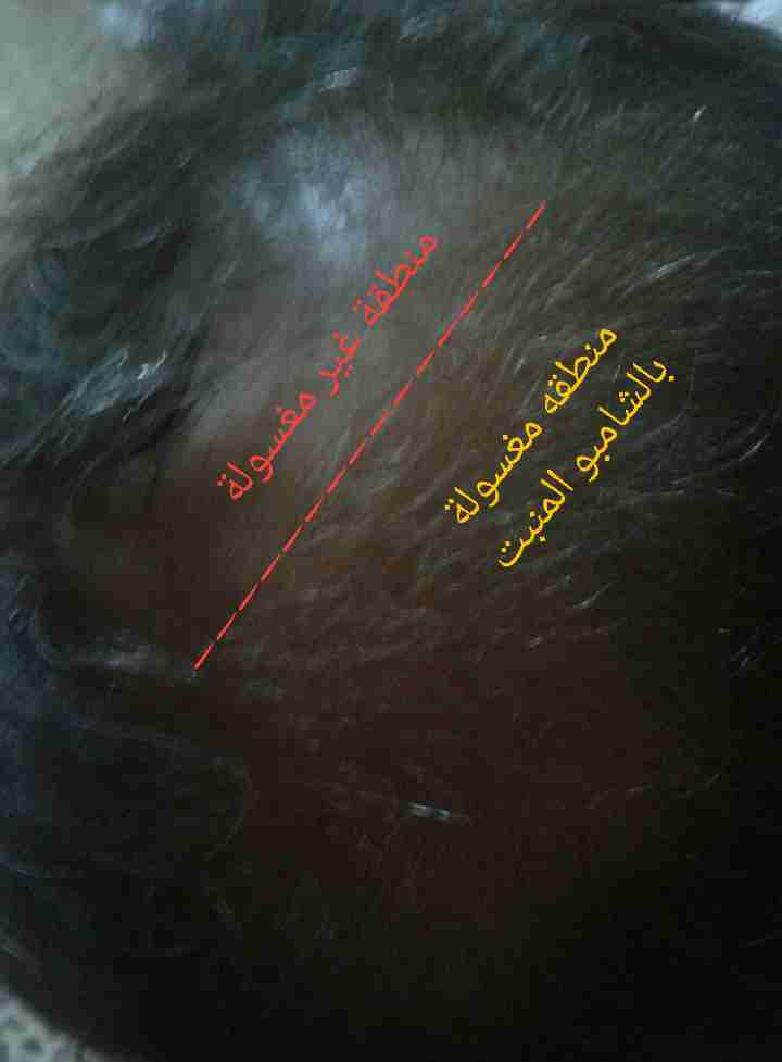 شامبو انبات الشعر القوي Repair,غير مصدق»
لا تنسَ أنك شاهدت هذا الإعلان في عنكبوت
شامبو...