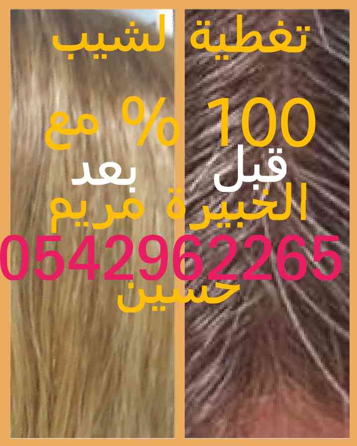 خبيرة تجميل متخرجة من المعهد العالي التخصصي
لا تنسَ أنك شاهدت هذا الإعلان في عنكبوت
تتوفر لي...