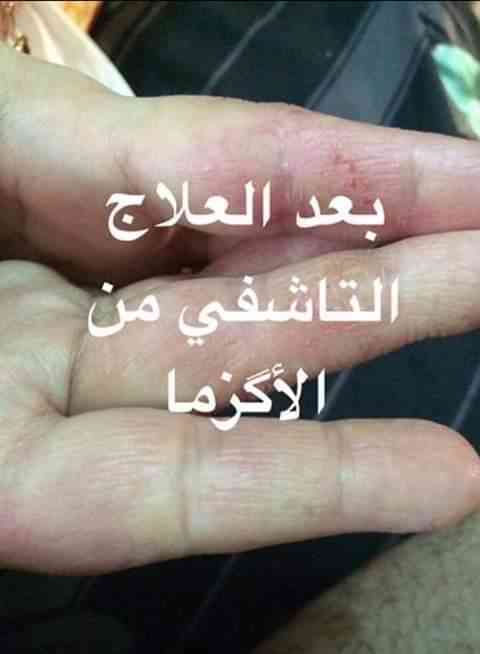 زبده الشيا الافريقيه عرض خاص الاصليه 100/100
لا تنسَ أنك شاهدت هذا الإعلان في عنكبوت
زبده ال...