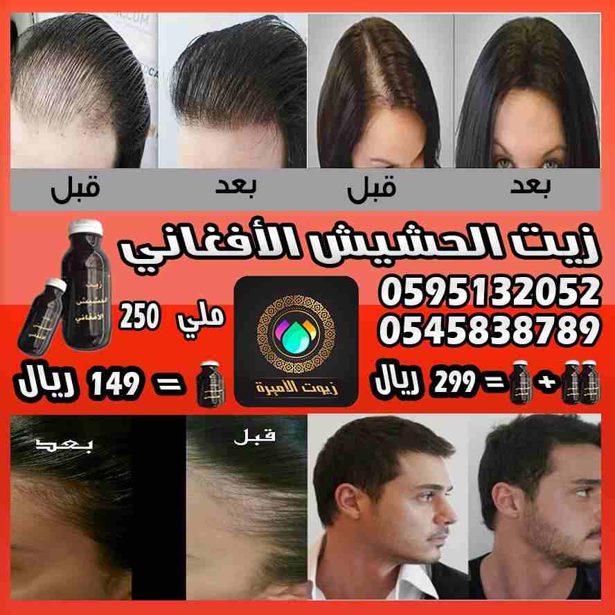 زييت الشعر الافغاني لتساقط الشعر اصلي و مجرب و فعال
لا تنسَ أنك شاهدت هذا الإعلان في عنكبوت
حصريا...