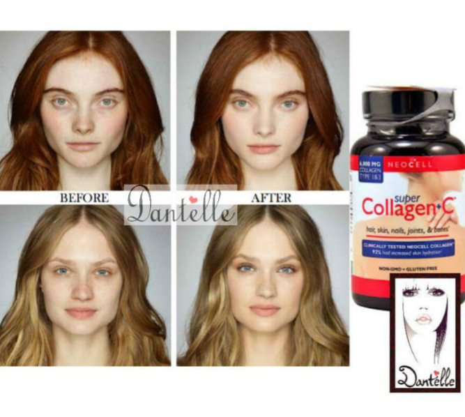حبوب الكولاجين الأمريكية
لا تنسَ أنك شاهدت هذا الإعلان في عنكبوت
#collagen
حبوب الكولاجين ال...