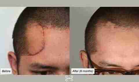 Luminesce products المنتج الامريكى                                            


	 				لا تنسَ أنك شاهدت هذا الإعلان في عنكبوت            
	 				
                                مصل السيرم :- أقوي...