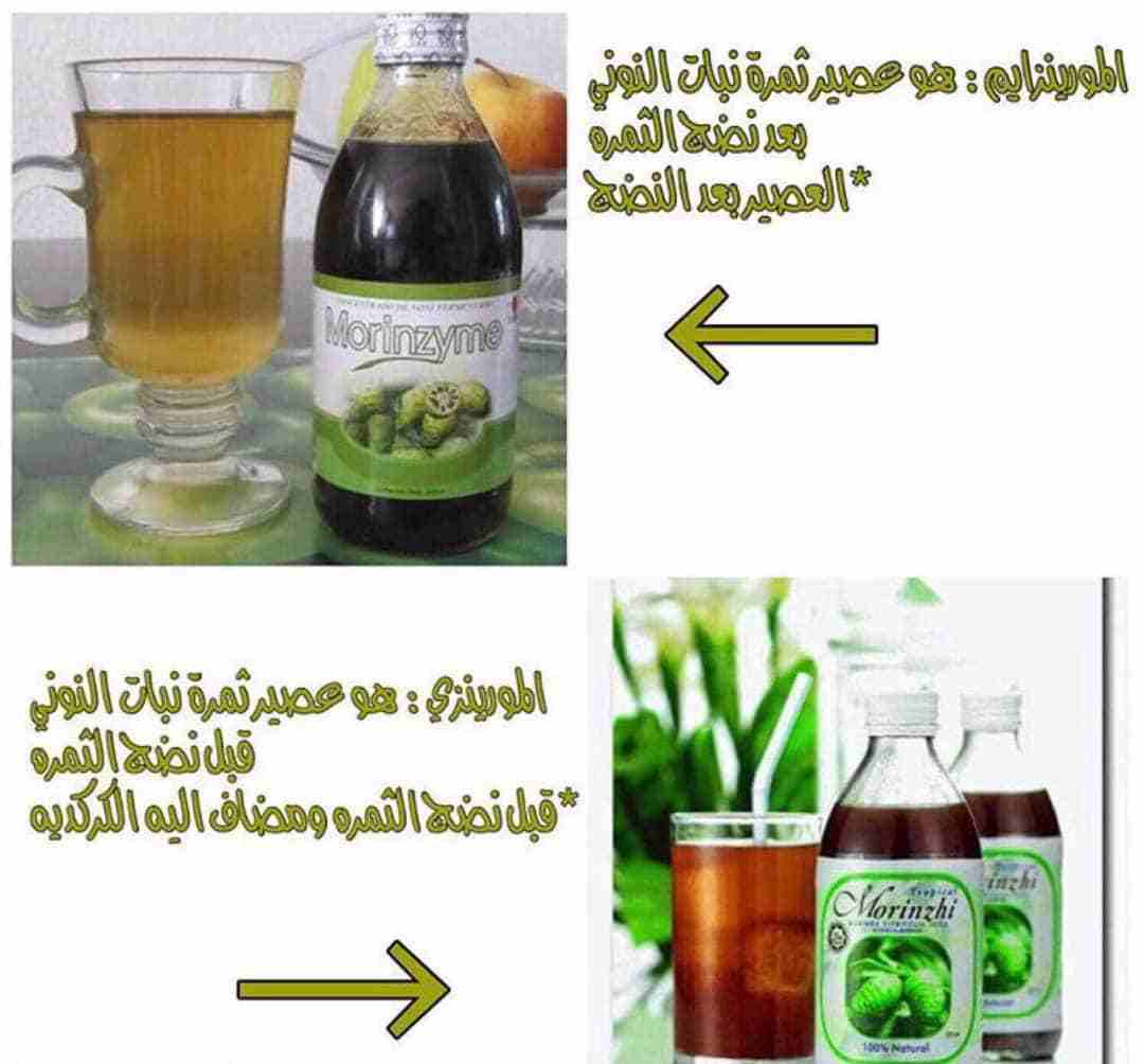 مكملات غذائيه ماليزيه تعمل ع خروج جميع الاسموم وتجديد الخلايا في الجسم
لا تنسَ أنك شاهدت هذا الإعلان في عنكبوت...