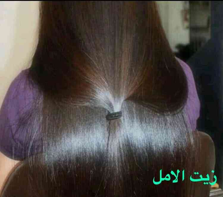 زيت الأمل لتنعيم الشعر وتطويله
لا تنسَ أنك شاهدت هذا الإعلان في عنكبوت
زيت الأمل
يساعد على ت...