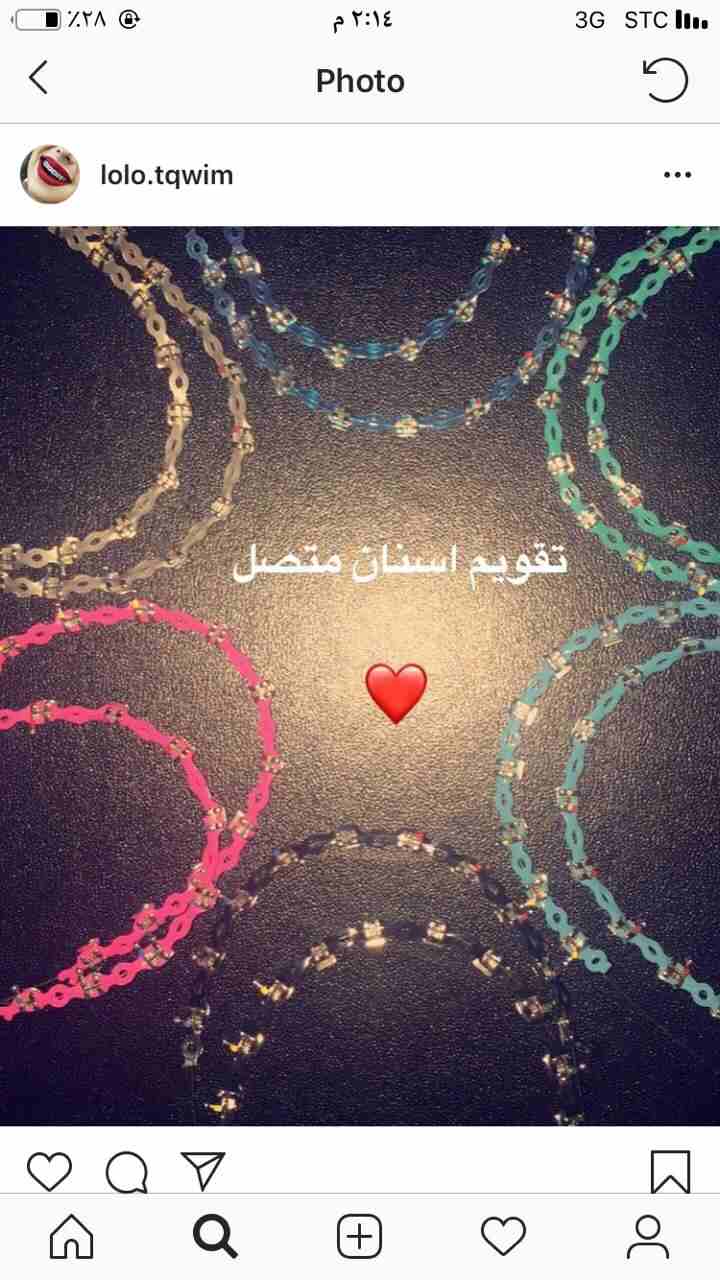 تقويم للبيع بسعر خاص كميه محدودة فكين مع لون                                            


	 				لا تنسَ أنك شاهدت هذا الإعلان في عنكبوت            
	 				
                            تقويم تقويم...