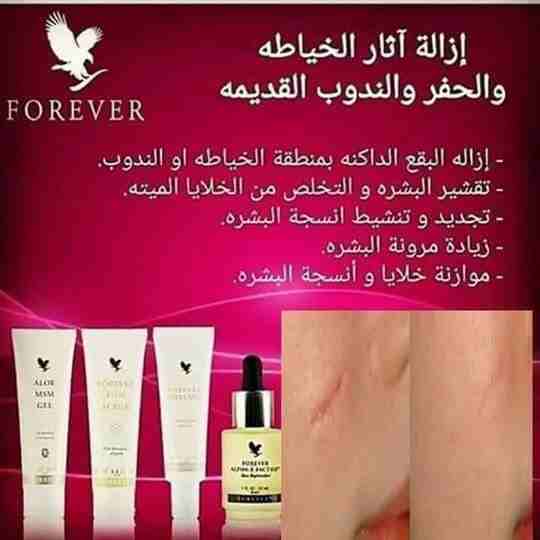 تمتع ببشره صافيه وتخلص من اثار الخياطة والندوب الان مع المجموعه السحريه سارع باغتنام مجموعة لك الان للاستفسار و الطلب ارسل واتس فقط 0505289638 مع توصيل و متابعه شامله خطوه