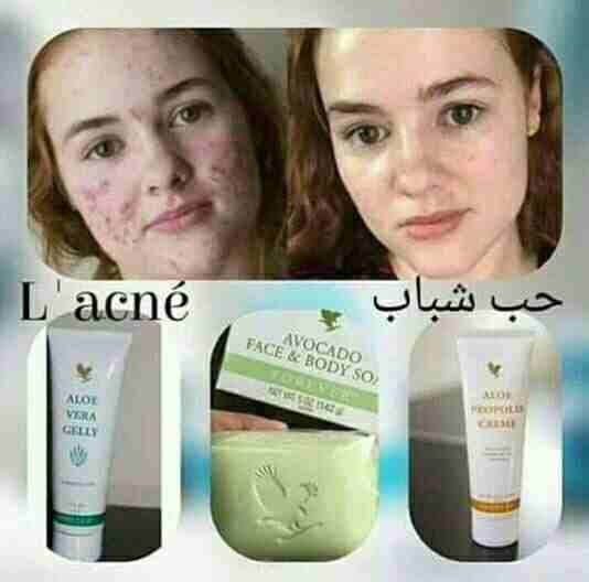 مجموعة حب الشباب من فوريفر الأمريكية 
&radic; يساعد على التخلص من الحبوب و آثارها 
&radic; ترطيب البشرة 
&radic; تعطي لمعان للبشرة
&radic; تعطي بياض للبشرة 
&radic; طبيعي 100%
&radic; مجرب و مضمون