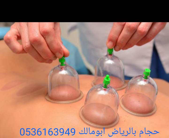 حجام بالرياض أبومالك 0536163949
*أخصائي للزيارات المنزلية
*خبرة ودراسة عملية أكثر من عشر سنوات
*أدوات جديدة ومعقمة لكل شخص
*جودة وإتقان - خبرة وأمان
*خدمة منزلية
*تكرار الحجامة اكثر من مرة للموضع
لل...
