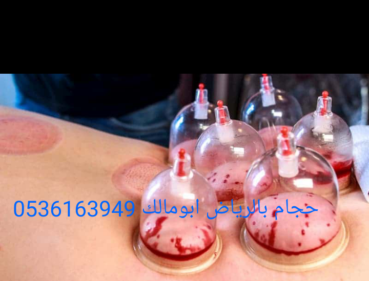 حجام بالرياض أبومالك 0536163949
*أخصائي للزيارات المنزلية
*خبرة ودراسة عملية أكثر من عشر سنوات
*أدوات جديدة ومعقمة لكل شخص
*جودة وإتقان - خبرة وأمان
*خدمة منزلية
*تكرار الحجامة اكثر من مرة للموضع
لل...