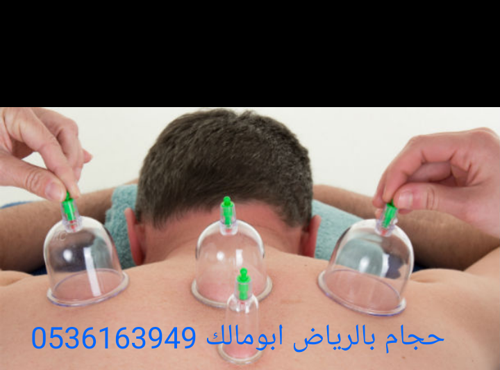 حجام بالرياض أبومالك 0536163949
*أخصائي للزيارات المنزلية 
*خبرة ودراسة عملية أكثر من عشر سنوات
*أدوات جديدة ومعقمة لكل شخص
*جودة وإتقان - خبرة وأمان
*خدمة منزلية
*تكرار الحجامة اكثر من مرة للموضع

لل...