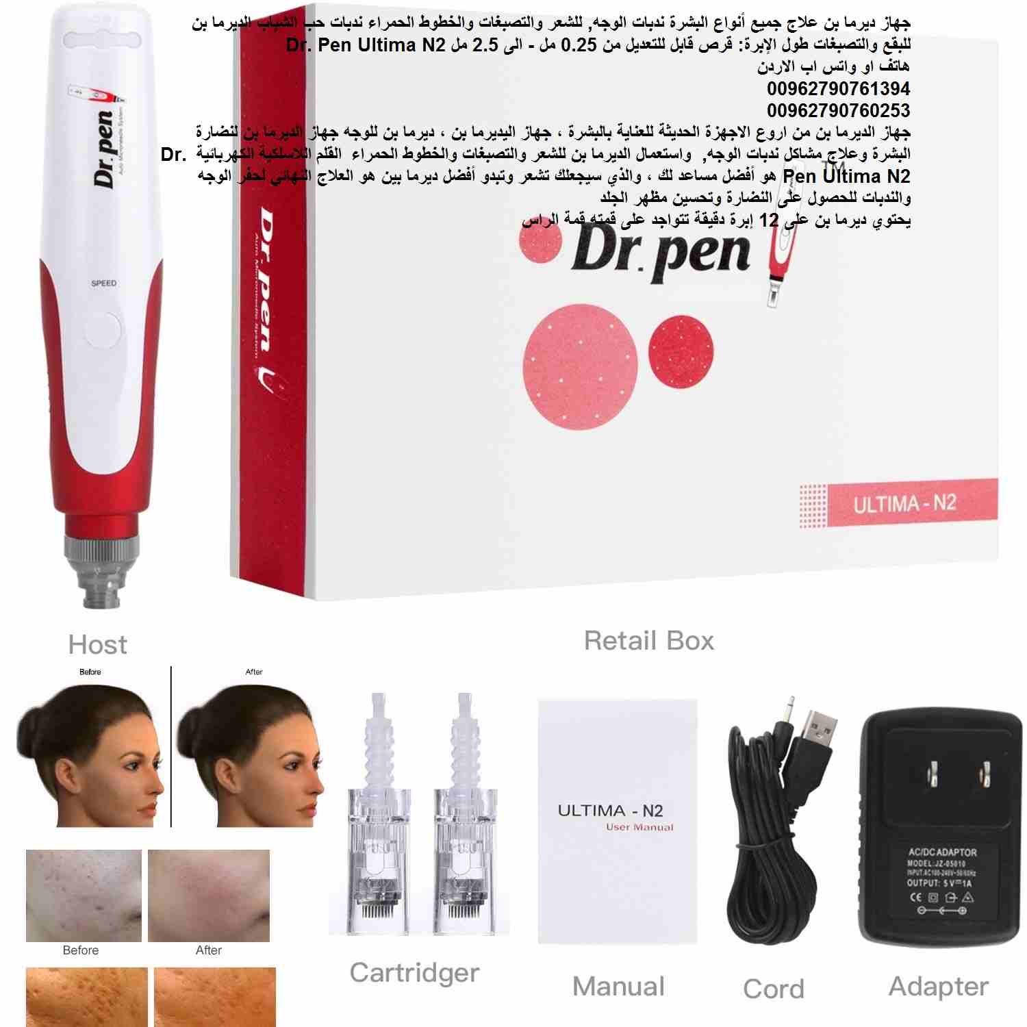 ديرما بن علاج جميع أنواع البشرة ندبات الوجه, للشعر والتصبغات والخطوط الحمراء ندبات حب الشباب الديرما بن للبقع والتصبغات طول الإبرة: قرص قابل للتعديل من 0.25 مل - الى 2.5 مل Dr. Pen Ultima N2
جهاز الدي...