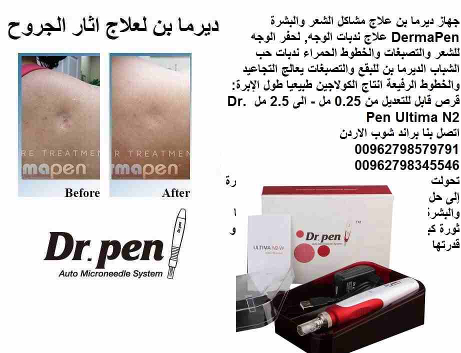 الة ديرما بن علاج مشاكل الشعر والبشرة (Derma Pen ) علاج ندبات الوجه, حفر الوجه للشعر والتصبغات والخطوط الحمراء ندبات حب الشباب الديرما بن للبقع والتصبغات يعالج التجاعيد والخطوط الرفيعة انتاج الكولاجين...