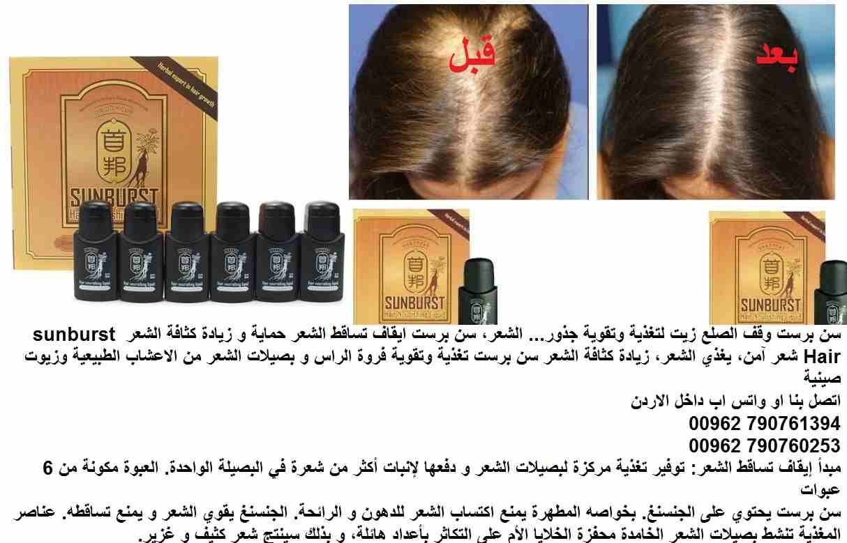 علاج تساقط الشعر | اعادة نمو الشعر؟ سن برست وقف الصلع زيت لتغذية وتقوية جذور( علاج الصلع ) ... الشعر، سن برست ايقاف تساقط الشعر حماية و زيادة كثافة الشعر sunburst Hair شعر آمن، يغذي الشعر، زيادة كثاف...