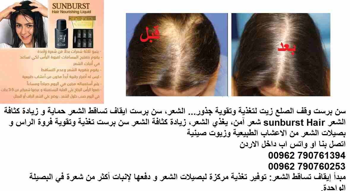 علاج تساقط الشعر | اعادة نمو الشعر؟ سن برست وقف الصلع زيت لتغذية وتقوية جذور( علاج الصلع ) ... الشعر، سن برست ايقاف تساقط الشعر حماية و زيادة كثافة الشعر sunburst Hair شعر آمن، يغذي الشعر، زيادة كثاف...